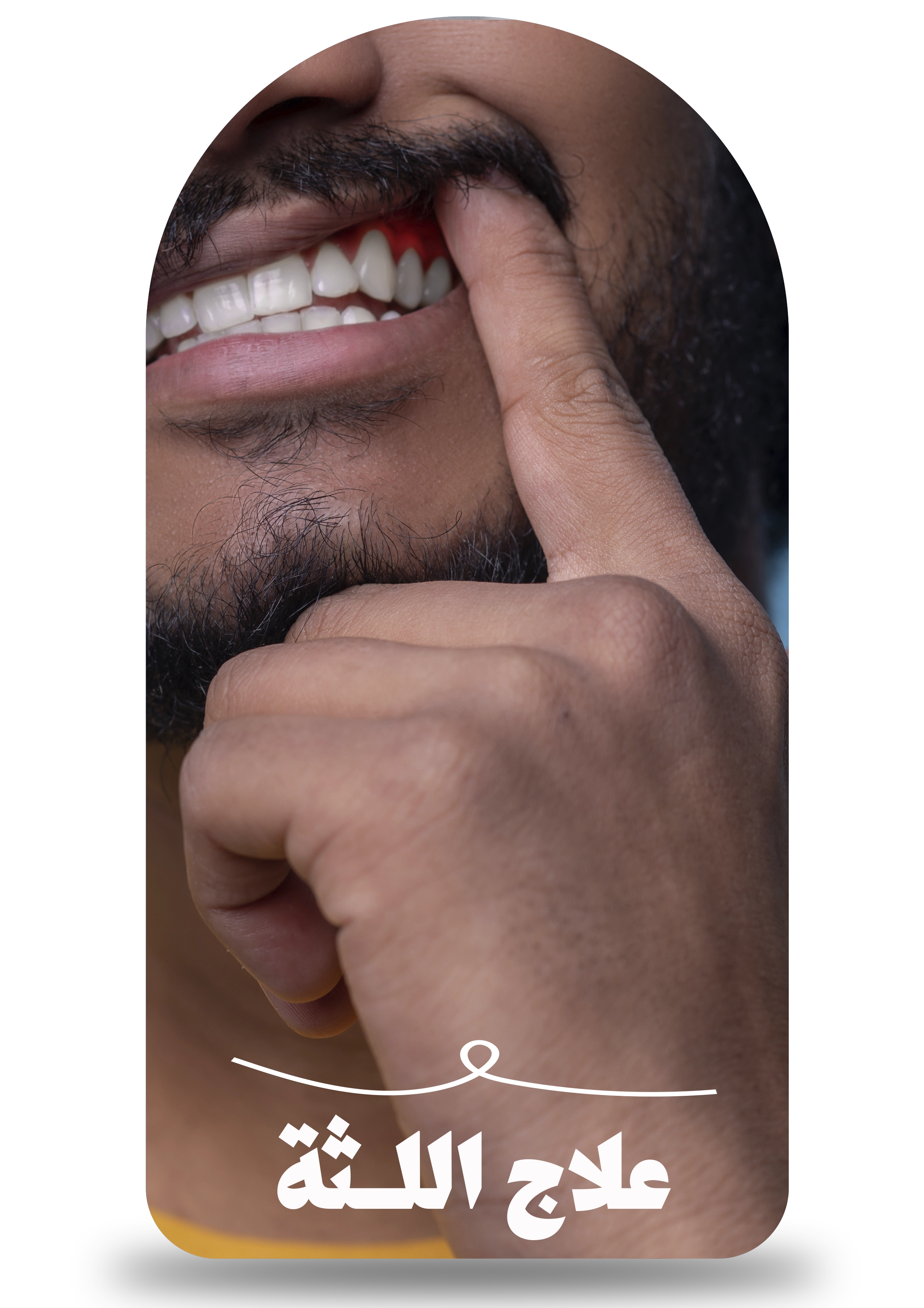 علاج اللثة
